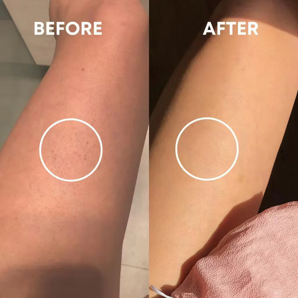 PinkGen Exfoliating Glove ™