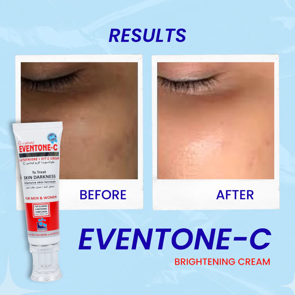 Eventone C Cream ( Skin whitening )™